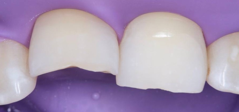 Before image