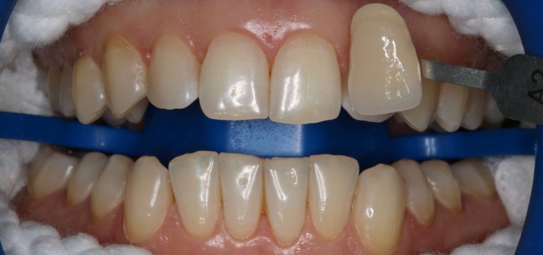 Before image