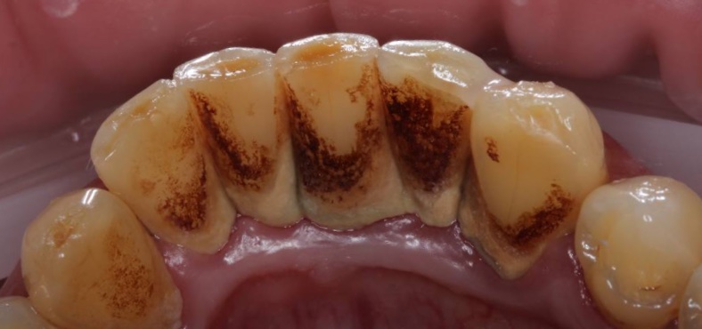 Before image