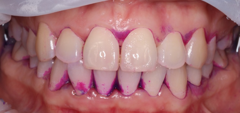 Before image