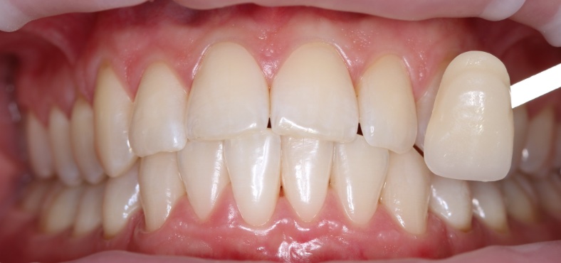 Before image