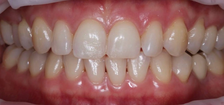 Before image
