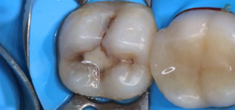 Before image