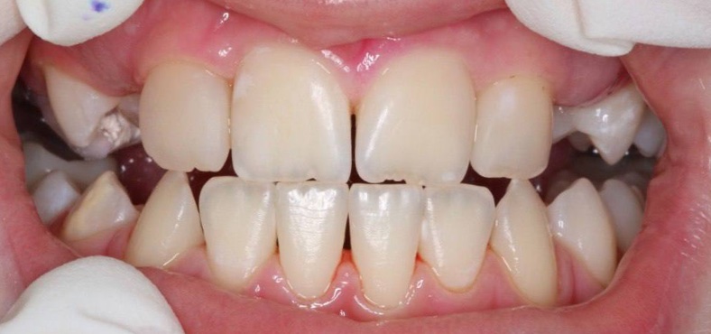 After image