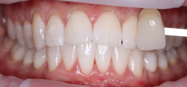 After image