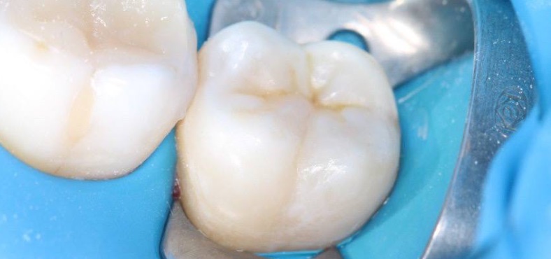 After image