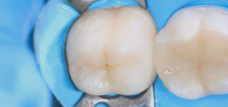 After image