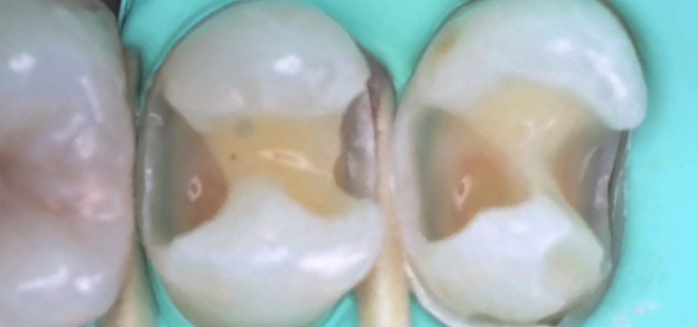 Before image